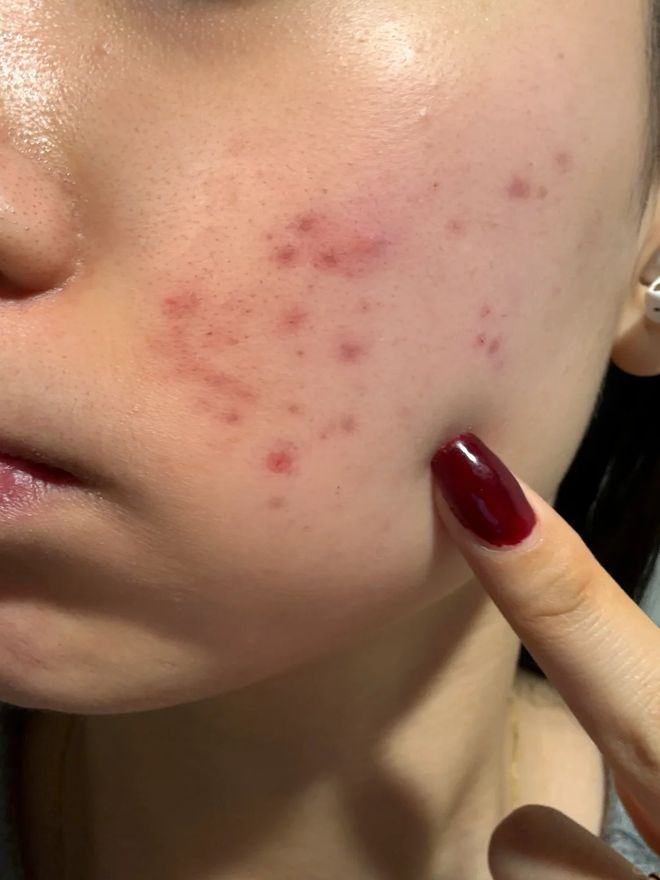 没换了？这种毛巾建议马上换掉AG真人平台